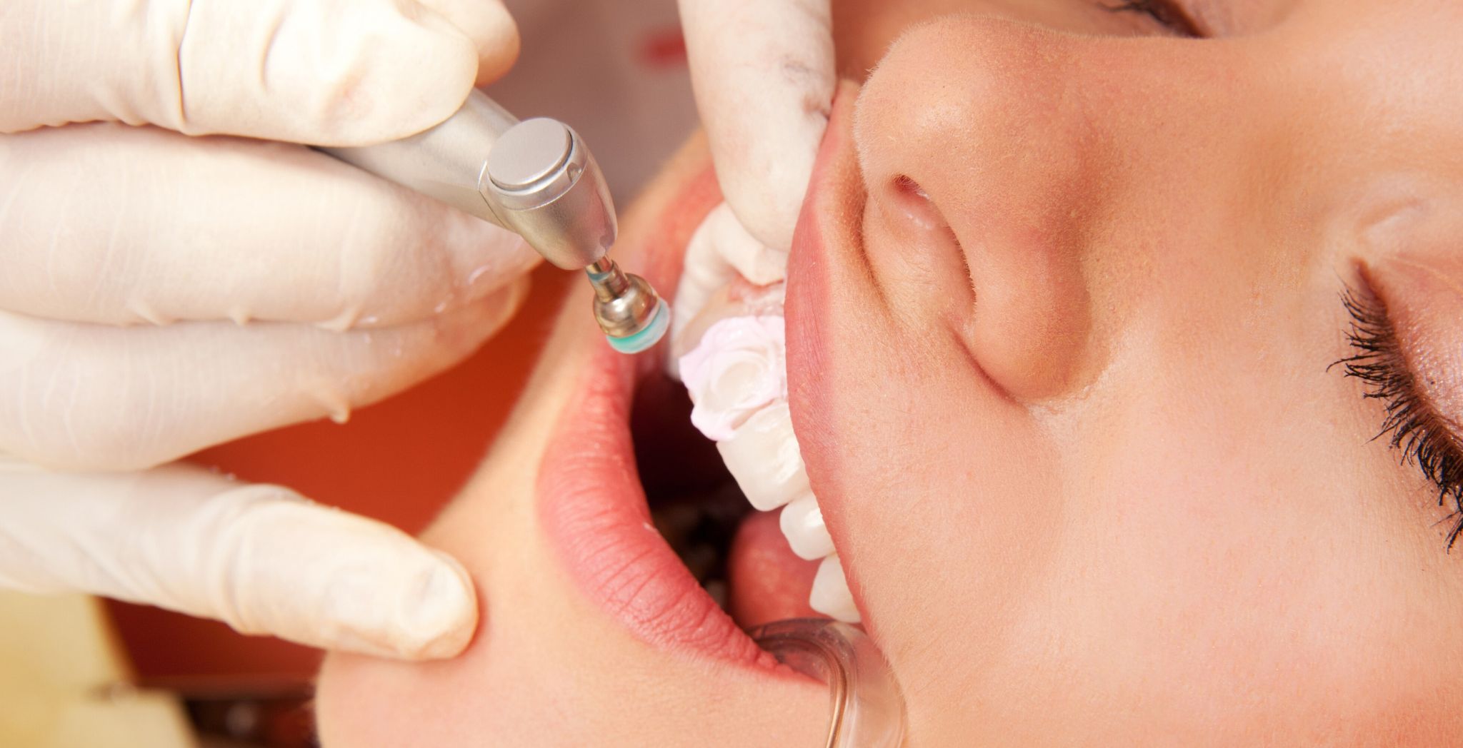 Dental bonding treatment, Cosmetic tooth bonding, Tooth gap bonding, Fixing chipped teeth with bonding, Teeth reshaping with bonding,